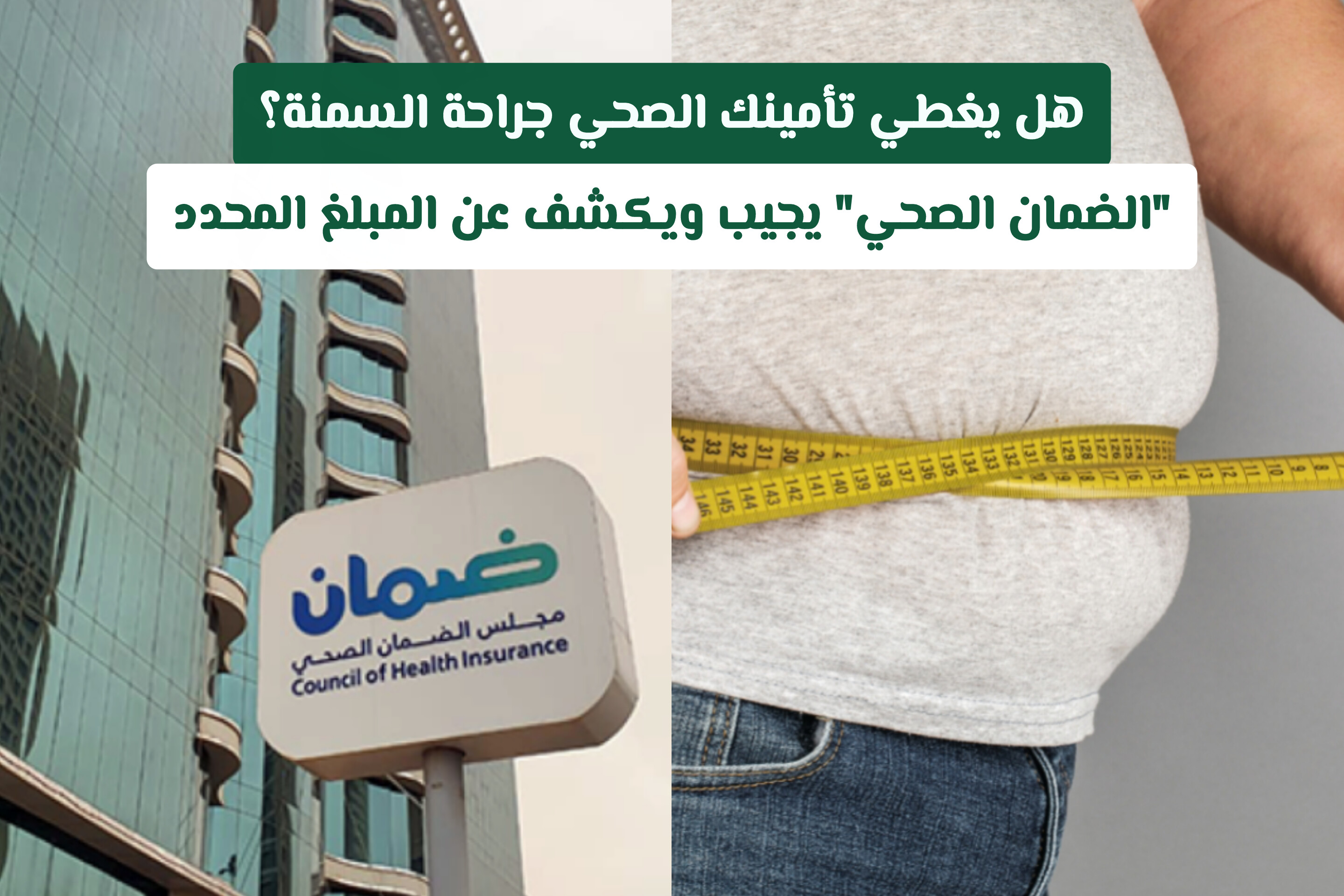 هل يغطي تأمينك الصحي جراحة السمنة؟ الضمان الصحي السعودي يجيب ويكشف عن المبلغ المحدد