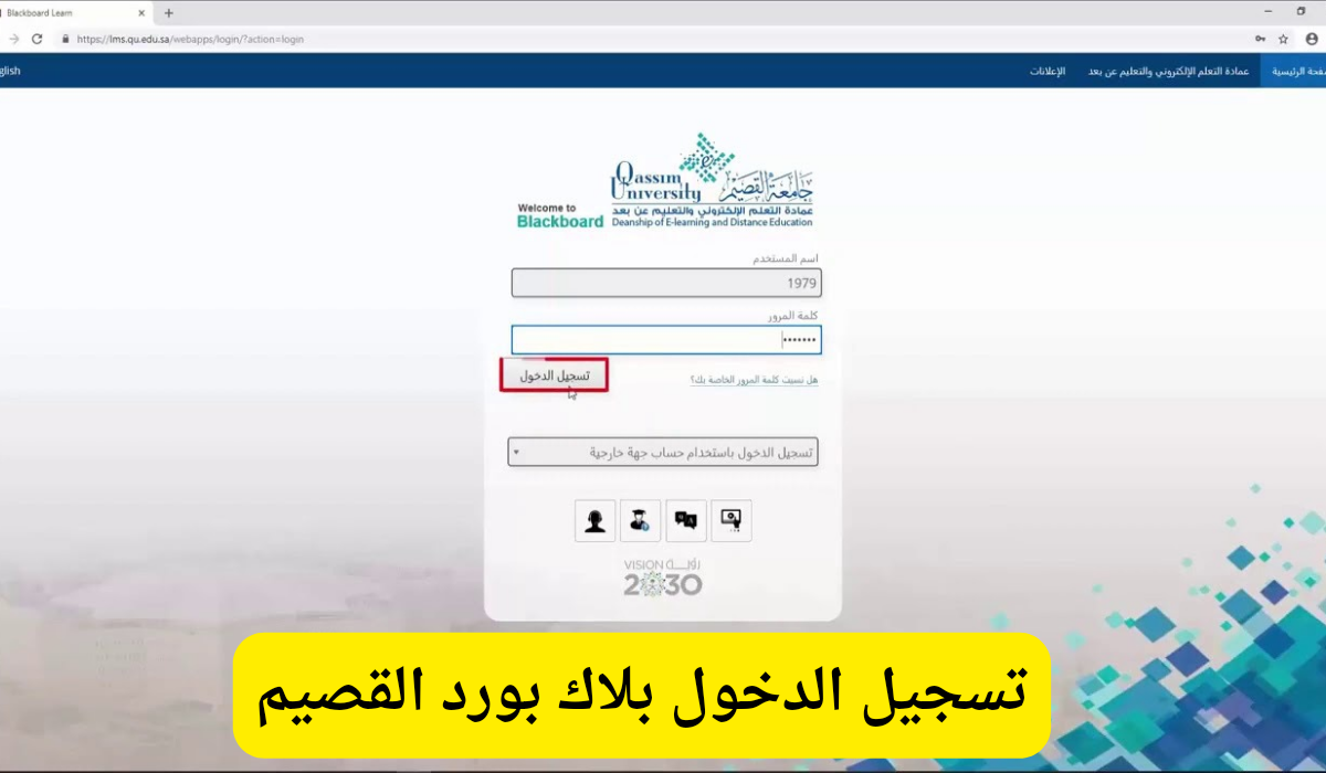 بلاك بورد القصيم